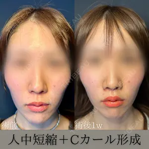 症例