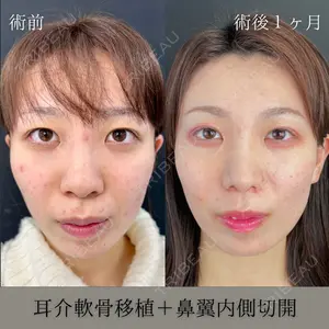 症例