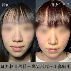 症例