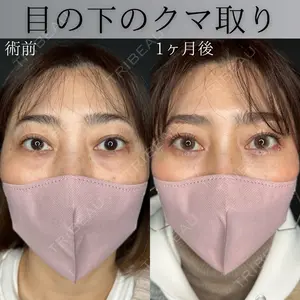症例