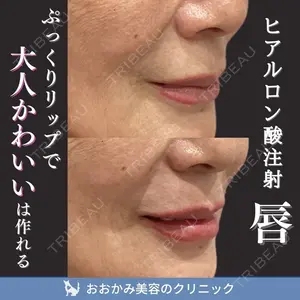 おおかみ美容のクリニック 新宿院 本郷 玲医師の症例