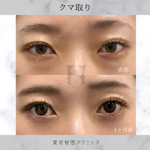 症例