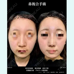 グローバルビューティークリニック 大阪院の症例