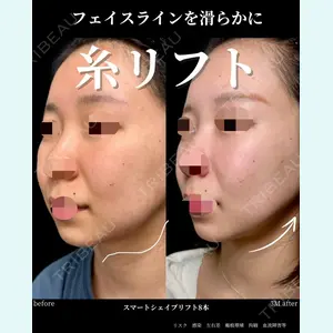 グローバルビューティークリニック 大阪院の症例