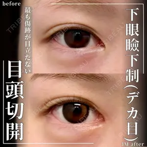 グローバルビューティークリニック 大阪院の症例