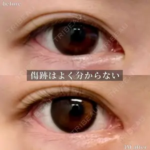 グローバルビューティークリニック 大阪院の症例
