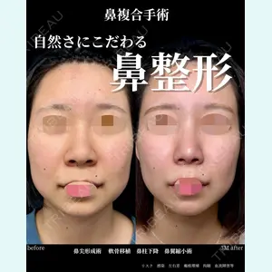 グローバルビューティークリニック 大阪院の症例