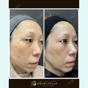 ゆきスキンクリニック 東池袋 小林 智之医師の症例