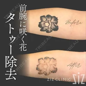 ziz CLINIC 村岡 史子医師の症例