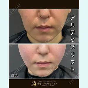 症例