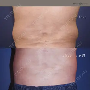 ガーデンクリニック 船橋院の症例