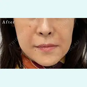 スマートスキンクリニック 石井 昇太医師の症例