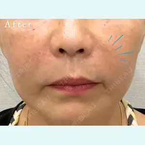 スマートスキンクリニック 石井 昇太医師の症例