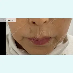 スマートスキンクリニック 石井 昇太医師の症例