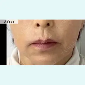 スマートスキンクリニック 石井 昇太医師の症例