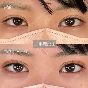 症例