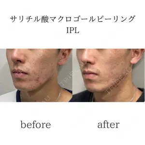 おおたかの森ビューティークリニックの症例