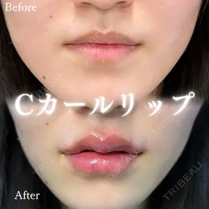 ルラ美容クリニック 大阪本院 平田 一記医師の症例