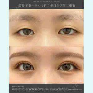 湘南美容クリニック 金山院の症例