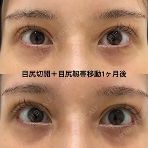 エターナル美容クリニック 久門田 詳医師の症例