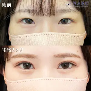症例