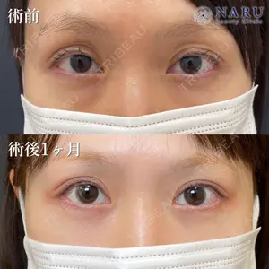 症例