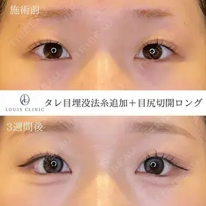 LOUIS CLINIC 二子玉川院【ルイクリニック】 小松 塁医師の症例