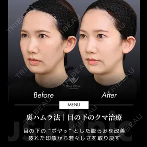 Otus Clinic 【オータスクリニック】 中 徳太郎医師の症例