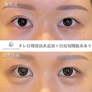 LOUIS CLINIC 二子玉川院【ルイクリニック】 小松 塁医師の症例