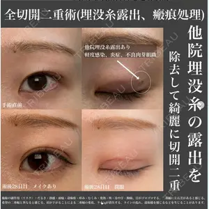 湘南美容クリニック 金山院の症例