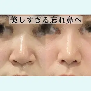 症例