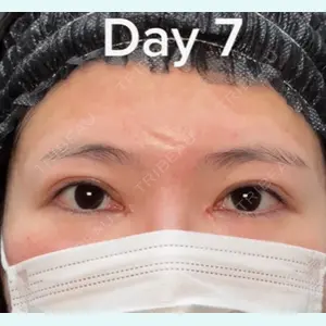 湘南美容クリニック 金山院の症例