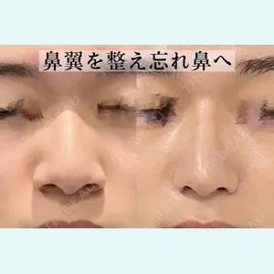 症例