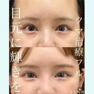 EMMO FACE CLINIC 大宮院 廣松 直樹医師の症例