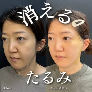 ルラ美容クリニック 渋谷本院 住友 沙織医師の症例