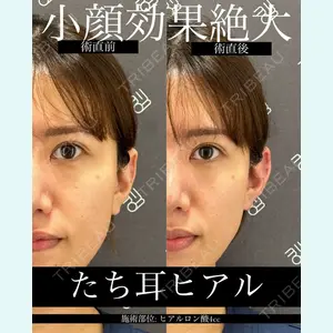 EMMO FACE CLINIC 大宮院 廣松 直樹医師の症例