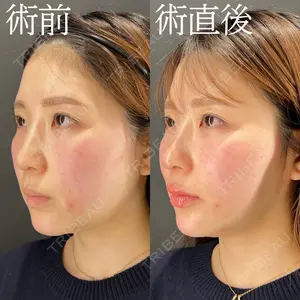 HAAB×DREAM BEAUTY CLINIC 大阪梅田院 柏木 太雅医師の症例