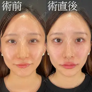 症例