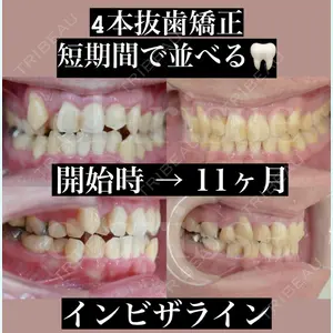 症例