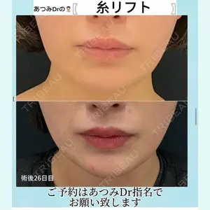 症例