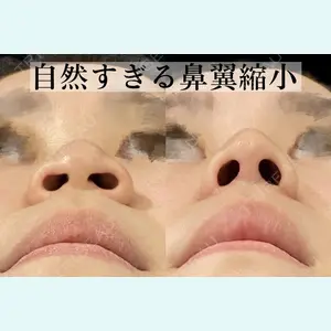 症例