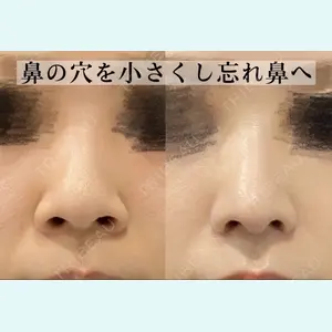 症例