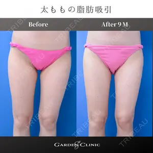 ガーデンクリニック 池袋院の症例