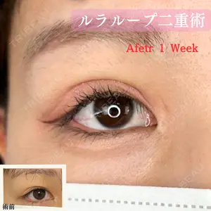 ルラ美容クリニック 神戸院の症例