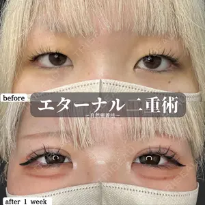 ルラ美容クリニック 神戸院の症例