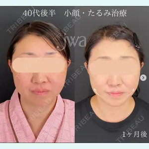 自由が丘ウェルエイジングビューティークリニック 福田 知佐子医師の症例