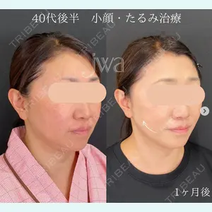 自由が丘ウェルエイジングビューティークリニック 福田 知佐子医師の症例