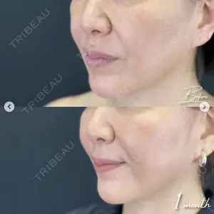湘南美容クリニック 松戸院の症例