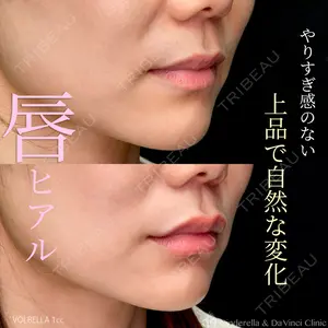 症例