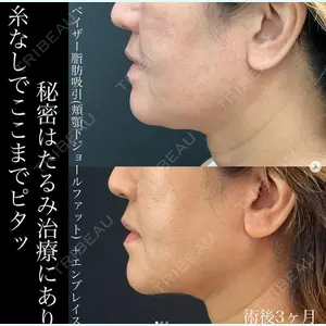 湘南美容クリニック 名古屋駅本院 豊嶋 沙良医師の症例